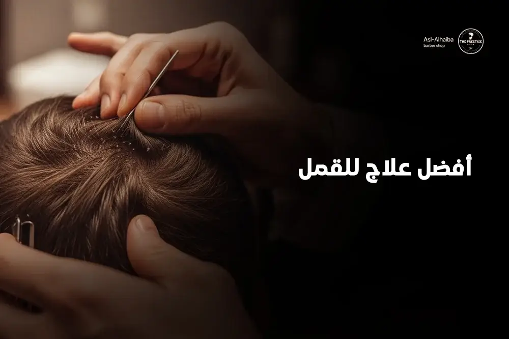 أفضل علاج للقمل