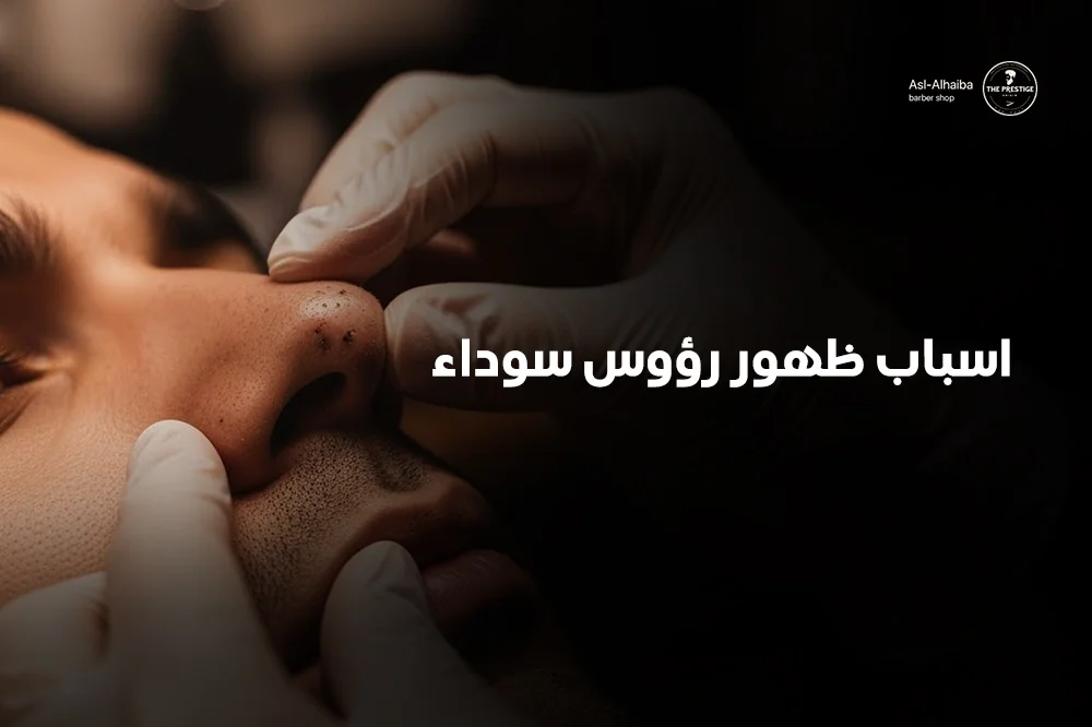 اسباب ظهور رؤوس سوداء