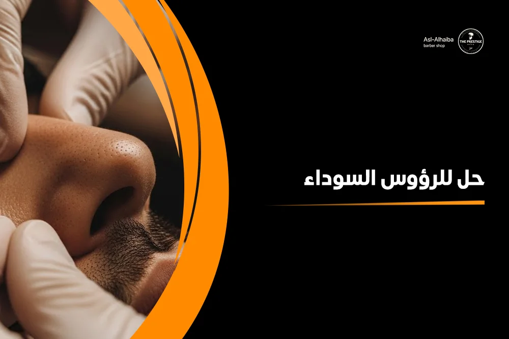 حل للرؤوس السوداء